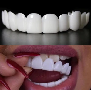 Комплект Горна и Долна ИНОВАТИВНА ПРОТЕЗА Snaponsmile
