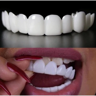 Комплект Горна и Долна ИНОВАТИВНА ПРОТЕЗА Snaponsmile