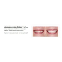 Комплект Горна и Долна ИНОВАТИВНА ПРОТЕЗА Snaponsmile