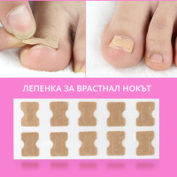 Лепенка за врастнал нокът ingrown toenail комплект от 50 броя