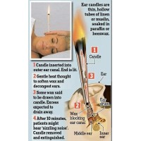 Восъчни свещи за почистване на уши 10 бр