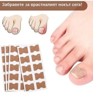 Лепенка за врастнал нокът ingrown toenail комплект от 50 броя